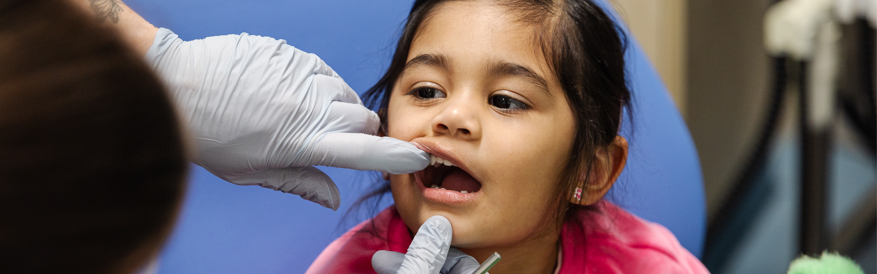 A dentist's gloved hand lifting a young girl's top lip to see her teeth